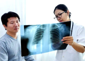 Inovasi Alat AI: Deteksi Tumor Paru Akurat via CT Scan