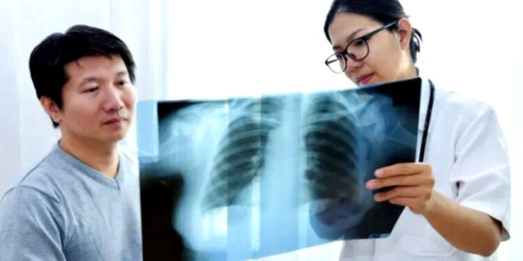 Inovasi Alat AI: Deteksi Tumor Paru Akurat via CT Scan