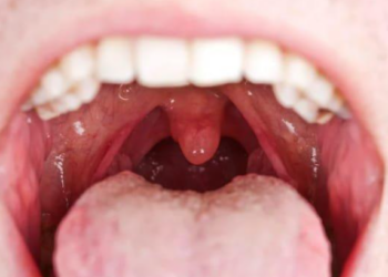 Apakah Menelan Ludah Bercampur Darah Membatalkan Puasa? Ini Penjelasannya