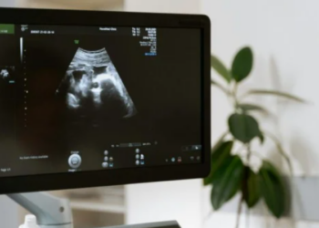 Heboh! Dokter Kandungan di Garut Diduga Lakukan Pelecehan Seksual Saat Pemeriksaan USG